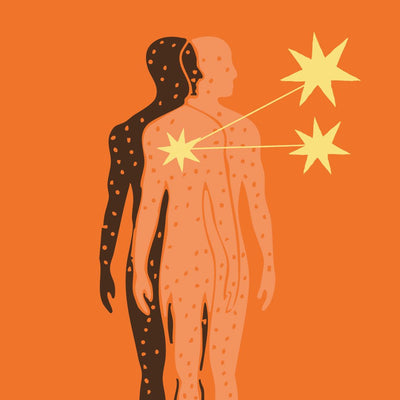Ansiedad: cuando el cuerpo se adelanta al presente